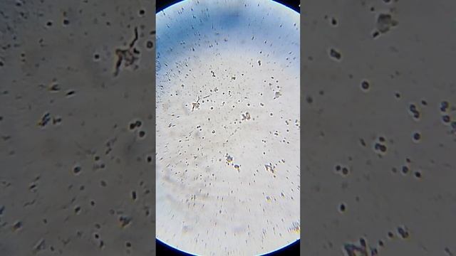 Инфузория под микроскопом