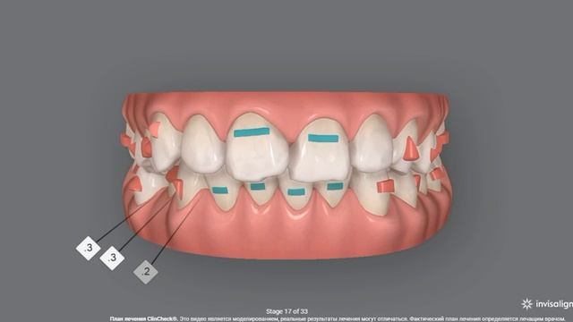 3D-моделирование вашей будущей улыбки. Стоматология Smile Spa Одинцово