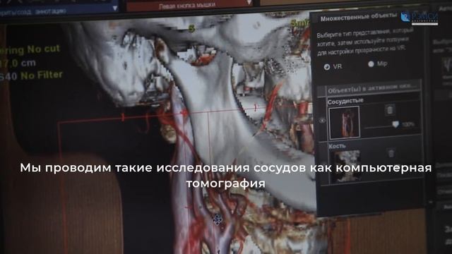 КТ слезных каналов с контрастом. Рэмси Диагностика