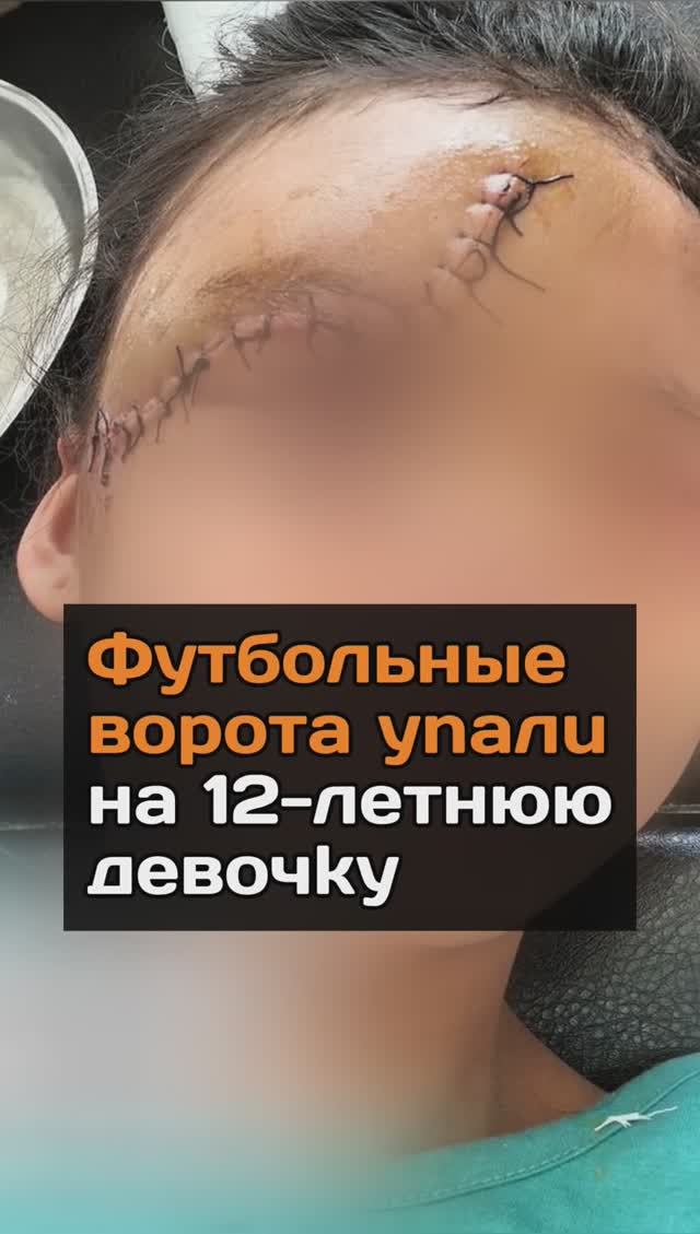 Футбольные ворота ynaлu на 12-летнюю дeвoчky