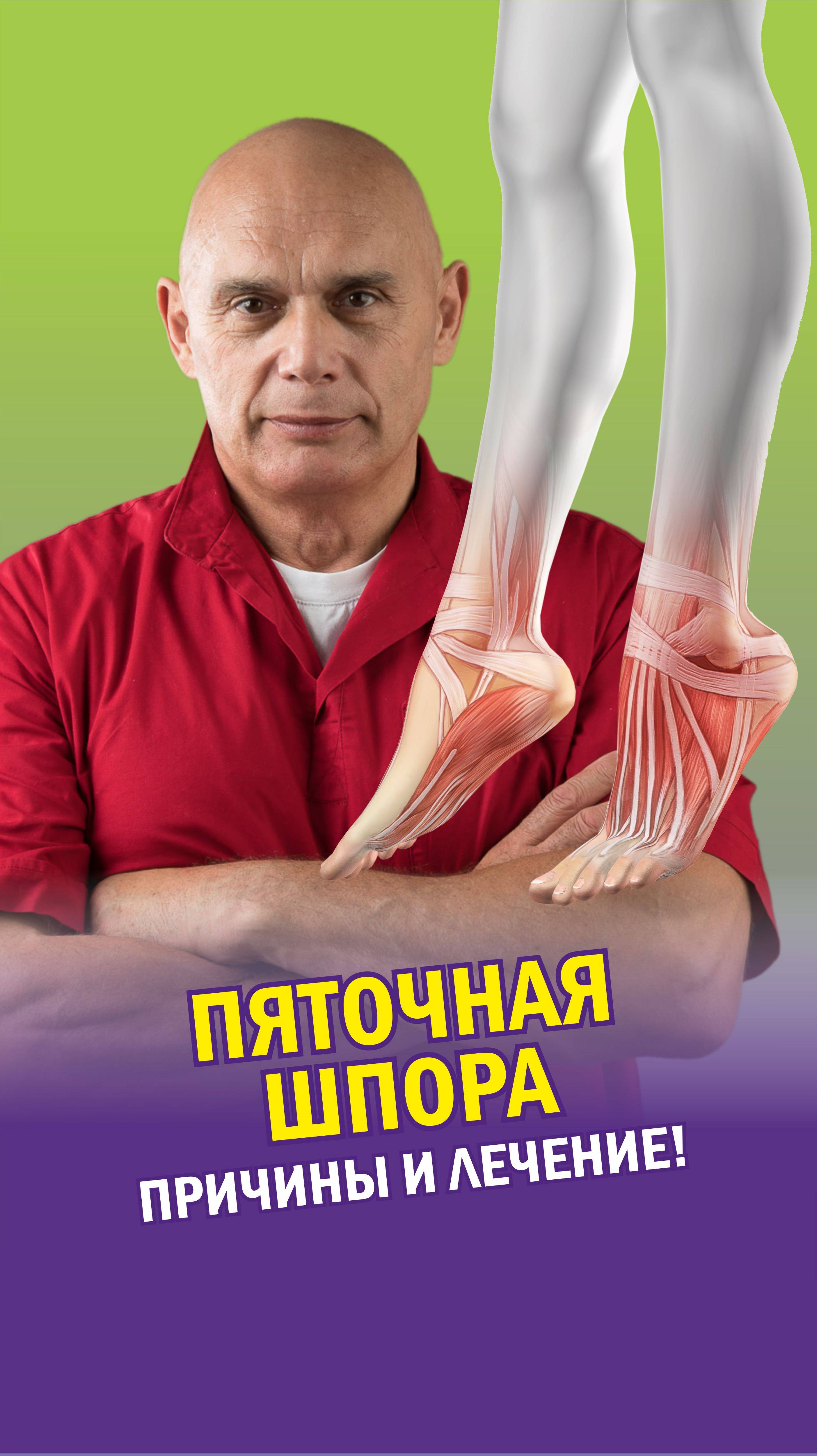 Пяточная шпора: причины и лечение.

#здоровье #медицина #суставы #пяточнаяшпора #лфк #бубновский38
