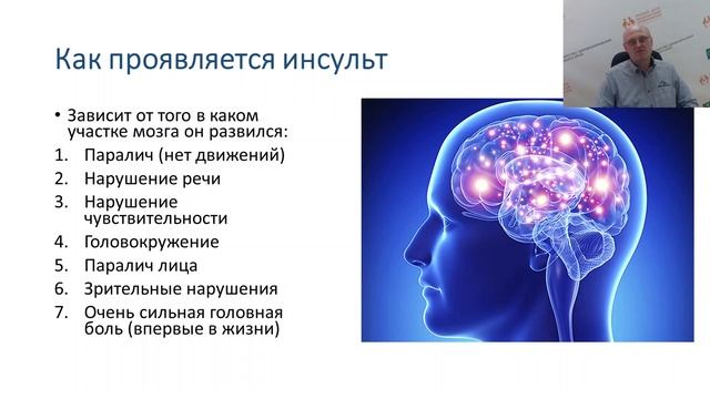 Что такое инсульт и как его победить? (Автор: Федянин С.А., главный внештатный невролог АК)