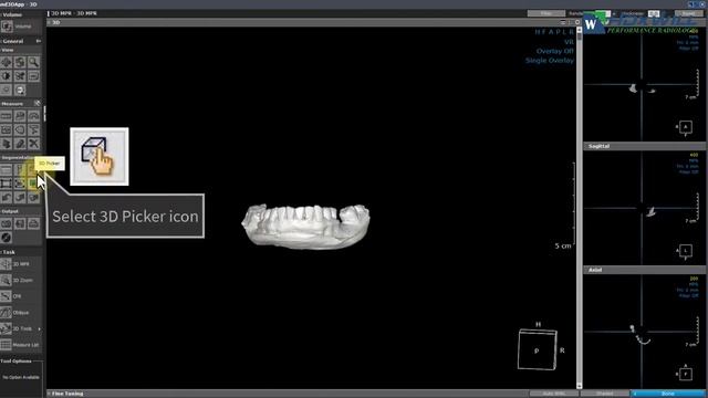 Dentri_ Model Scan Stand Guide