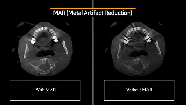 Dentri Max, Everything You Need for Your Growing Practice