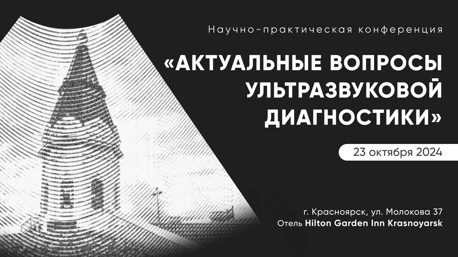 3. Возможности ультразвуковой диагностики опухолей желудочно-кишечного тракта