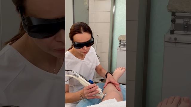 Лазерная эпиляция волос на аппарате DEKA