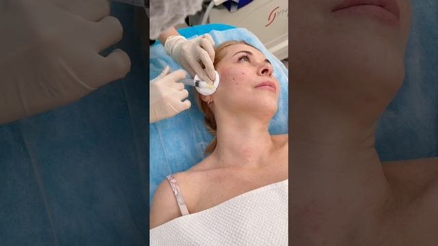 Коллагенотерапия AestePfill