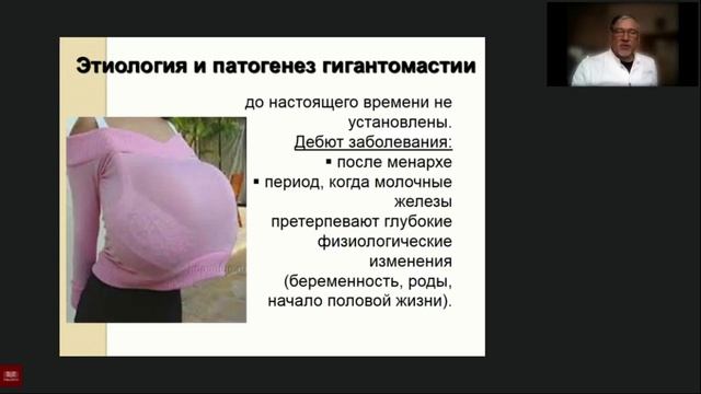 ПАТОЛОГИЯ МОЛОЧНЫХ ЖЕЛЕЗ У ДЕТЕЙ