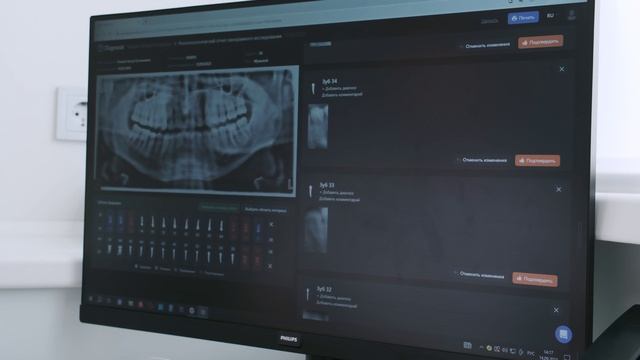 Искусственный интеллект в стоматологии «Стомус»