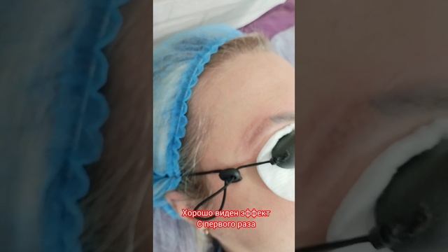 Лазерное удаление татуажа бровей Ноябрьск
#permanent_Irina_f