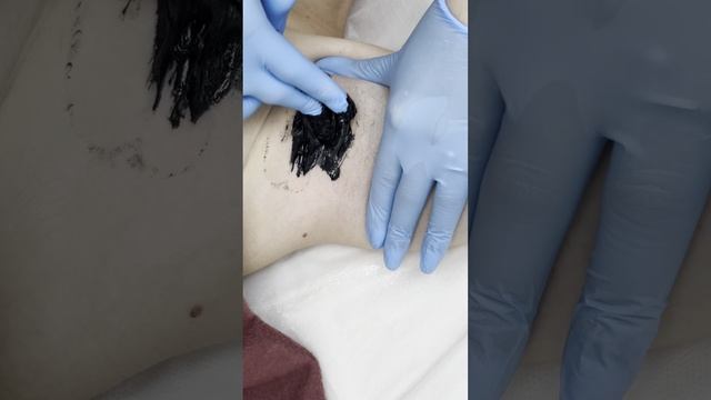 Шугаринг подмышек пастой Monochrome от технолога сети салонов эпиляции WAX BAR в Екатеринбурге