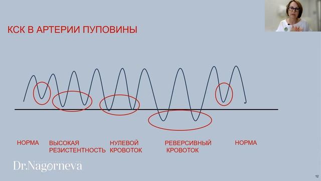 1.1 Лекция 1 Основы допплерометрия