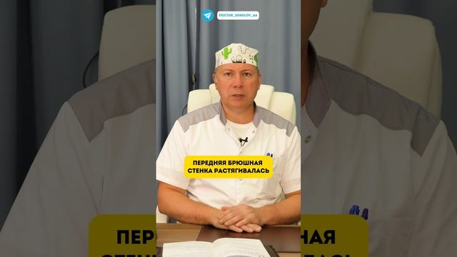 Повторная абдоминопластика, кто в зоне риска?  Часть 1