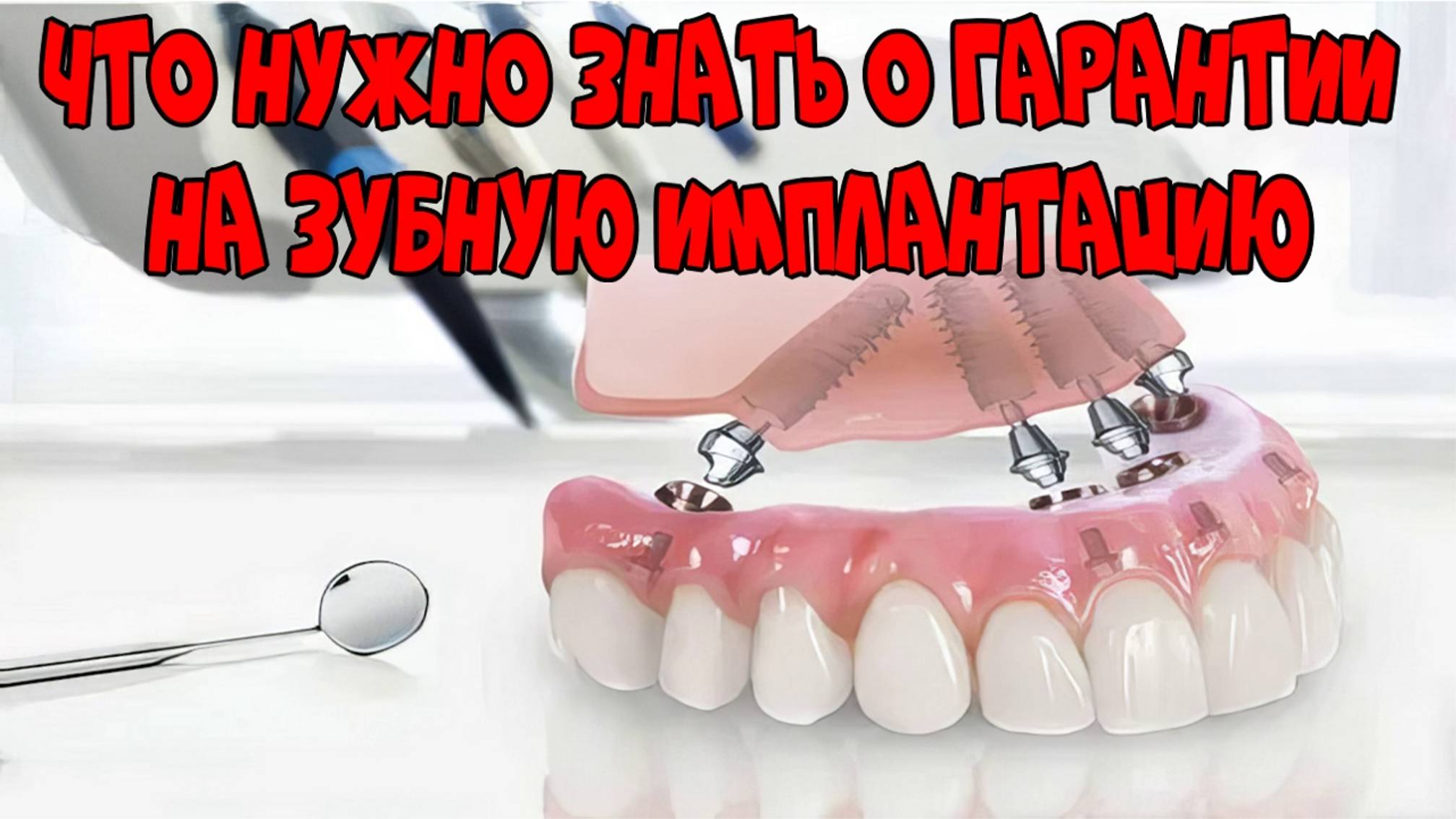 Все, что нужно знать о гарантии на зубную имплантацию.