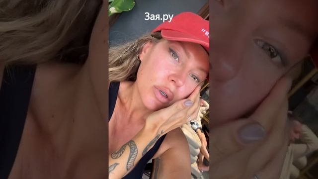Рита Дакота показала лицо после операции
