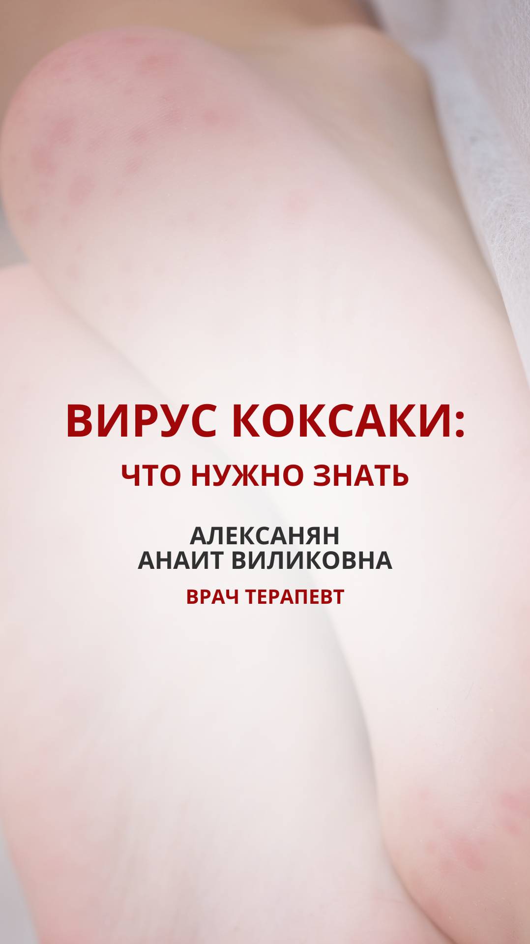 Вирус Коксаки: что нужно знать📢 Дорогие пациенты!

С начала ноября в Москве и Подмосковье фиксирует