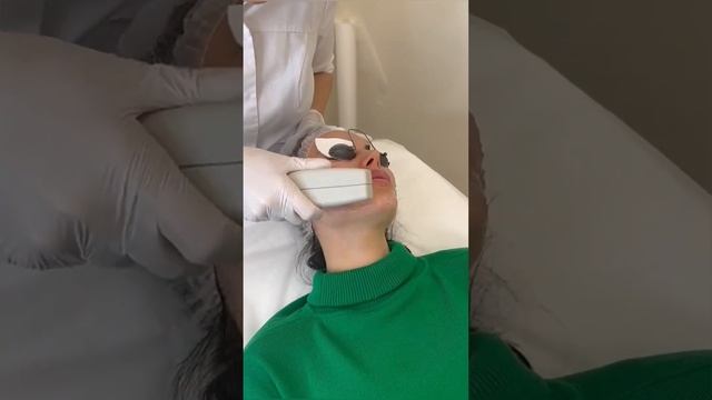 Фототерапия BBL