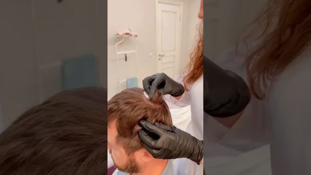 Плазмотерапия головы