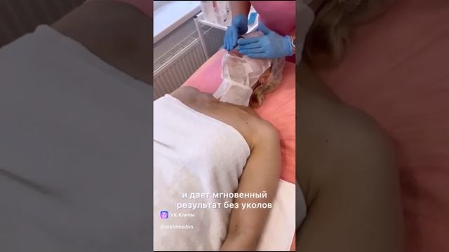 Карбокситерапия