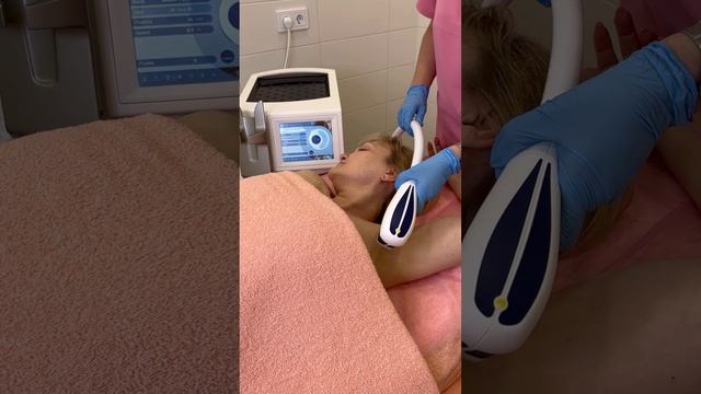 Лазерная эпиляция подмышек