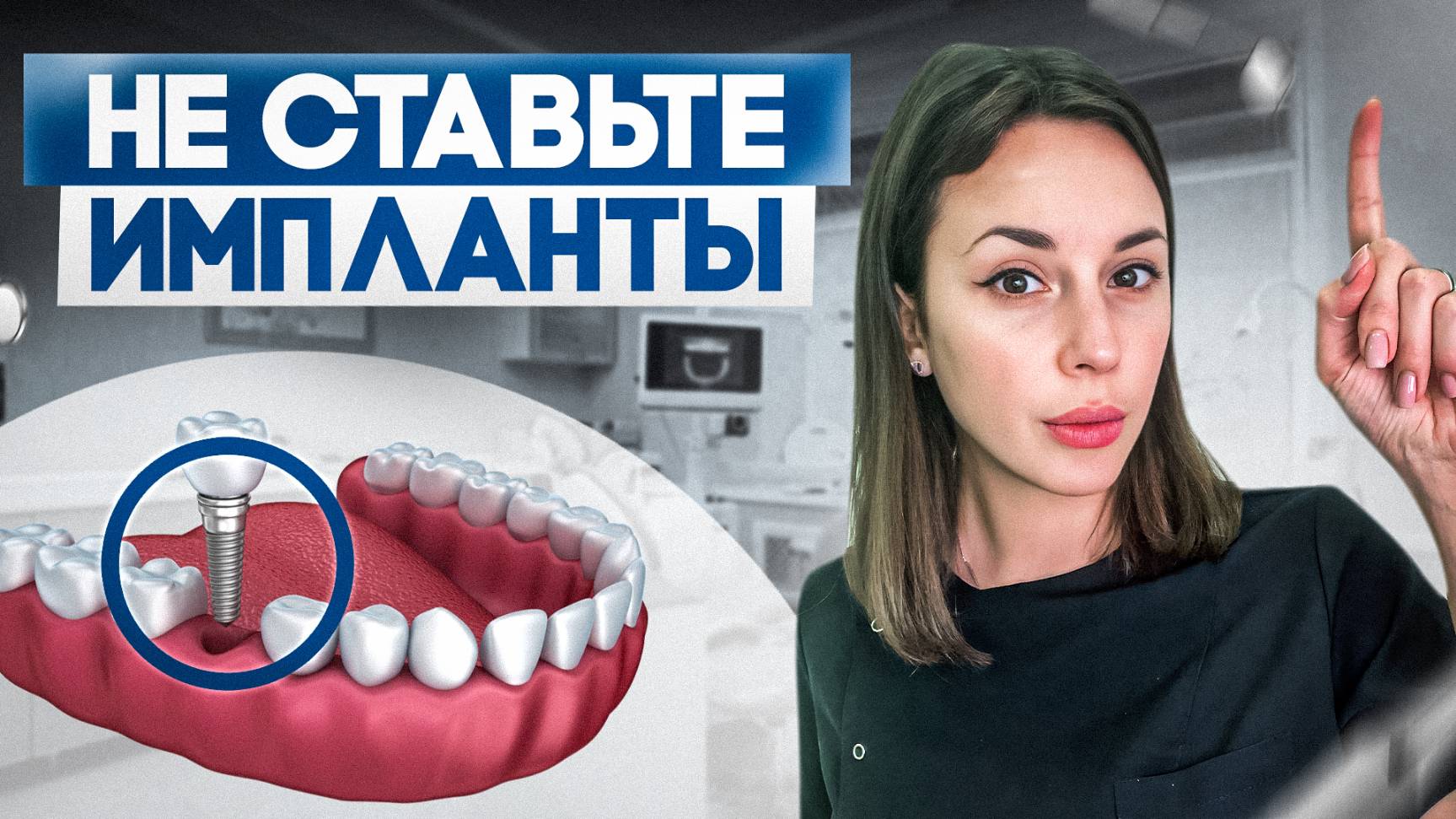 Не ставьте импланты пока не посмотрите это видео! Кому нельзя ставить импланты