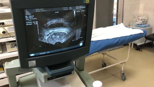 Биопсия простаты под общей анестезией в Омске