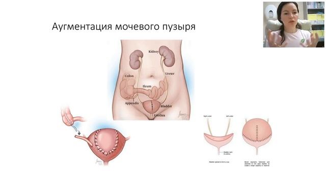 Час с урологом-4