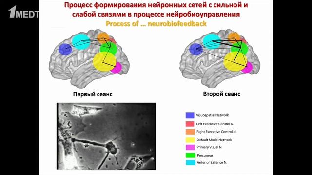 Запись с 4-го конгресса «Экология мозга:». Штарк М.Б. «Новое поколение нейротерапии»