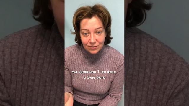 Отзыв по работе с морщинами в технике НейроОбаяние