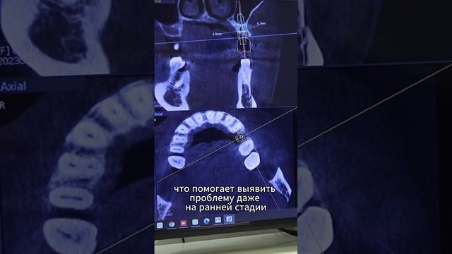 Implant clinic