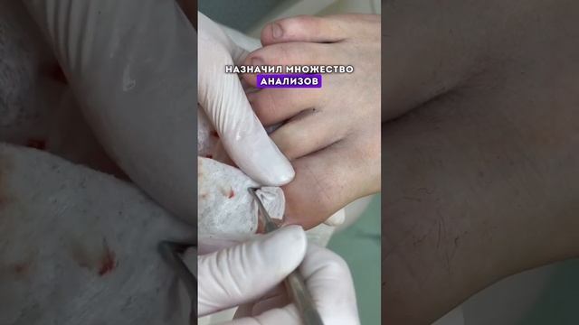 Как избежать проблемы вросшего ногтя? Читай в комментариях