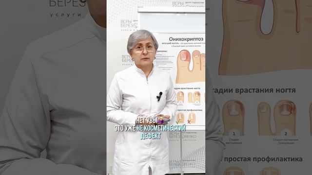 3 мифа о состоянии вросшего ногтя