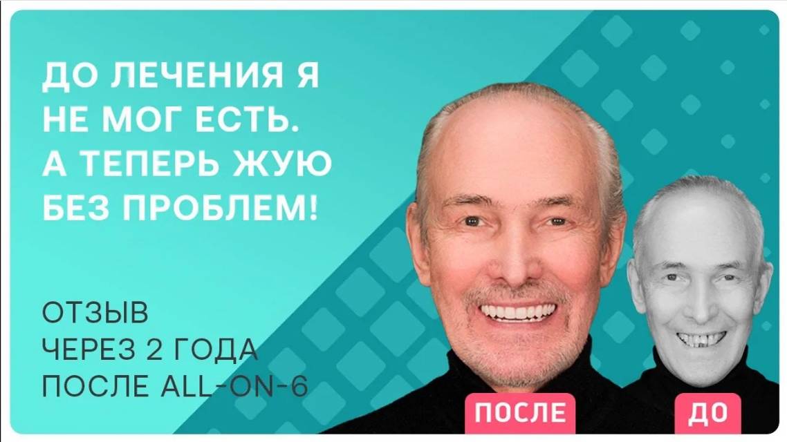 С какими трудностями придется столкнуться после all-on-6? Делюсь личным опытом