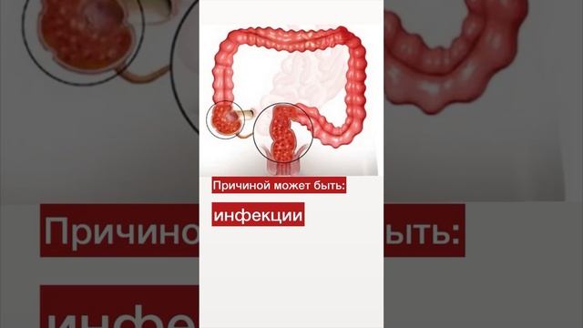 Причина повышения СОЭ в анализе крови