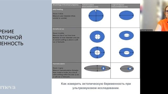 10.6 лекция. ВНЕМАТОЧНАЯ БЕРЕМЕННОСТЬ