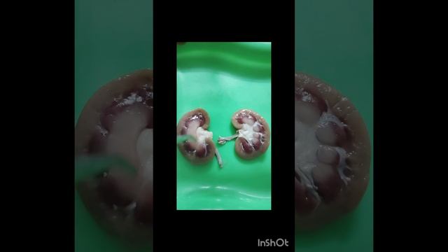 Internal structure of KIDNEY