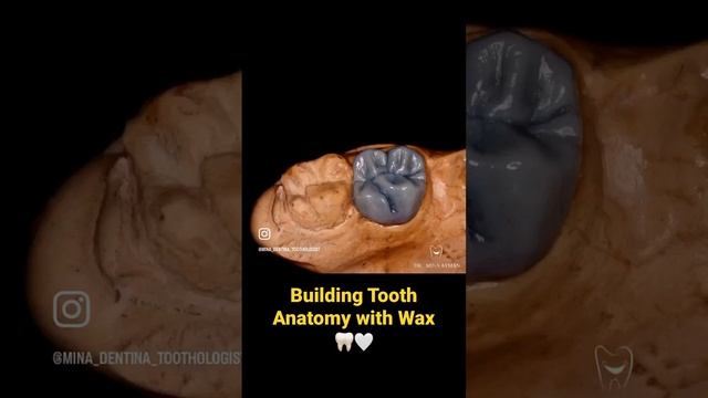 Wax Up building dental tooth anatomy 🦷🤍 ( Renfert Occlusal compass)