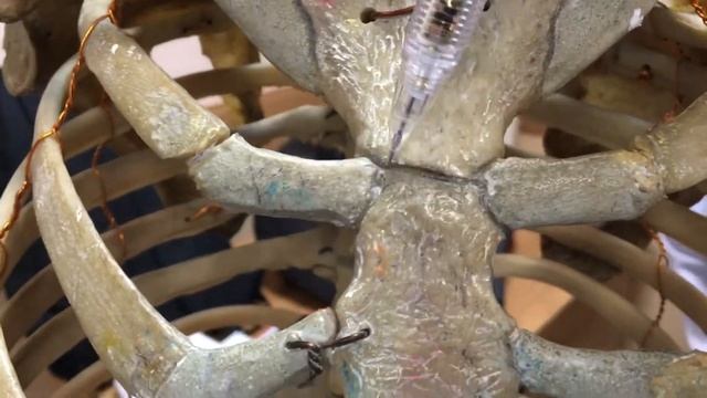 Sternum bone