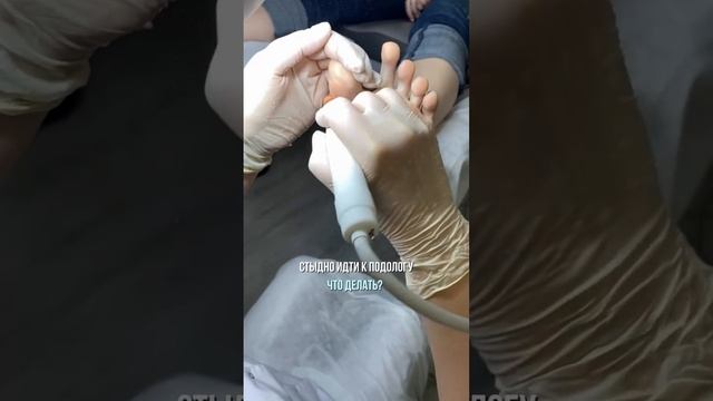 Стыдно идти к подологу. Что делать?