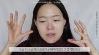 my acne is back and I'm okay with it & minimalistic routine | Soobeauty