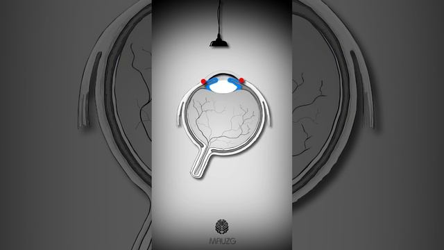 Глаукома простыми словами 👀