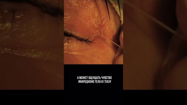 Дирофиляриоз обусловлен инфекцией паразитическими червями, известными как дирофилярии.