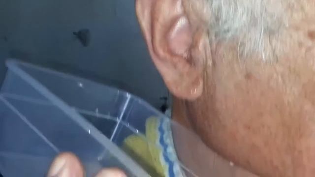 Промывание ушка|||||Пробочка ушная