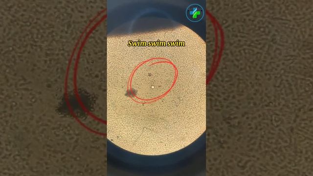 Semen Analysis | Active spermatozoa | Semen Examination