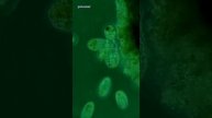 Group of Coleps Cells Devour Ciliate