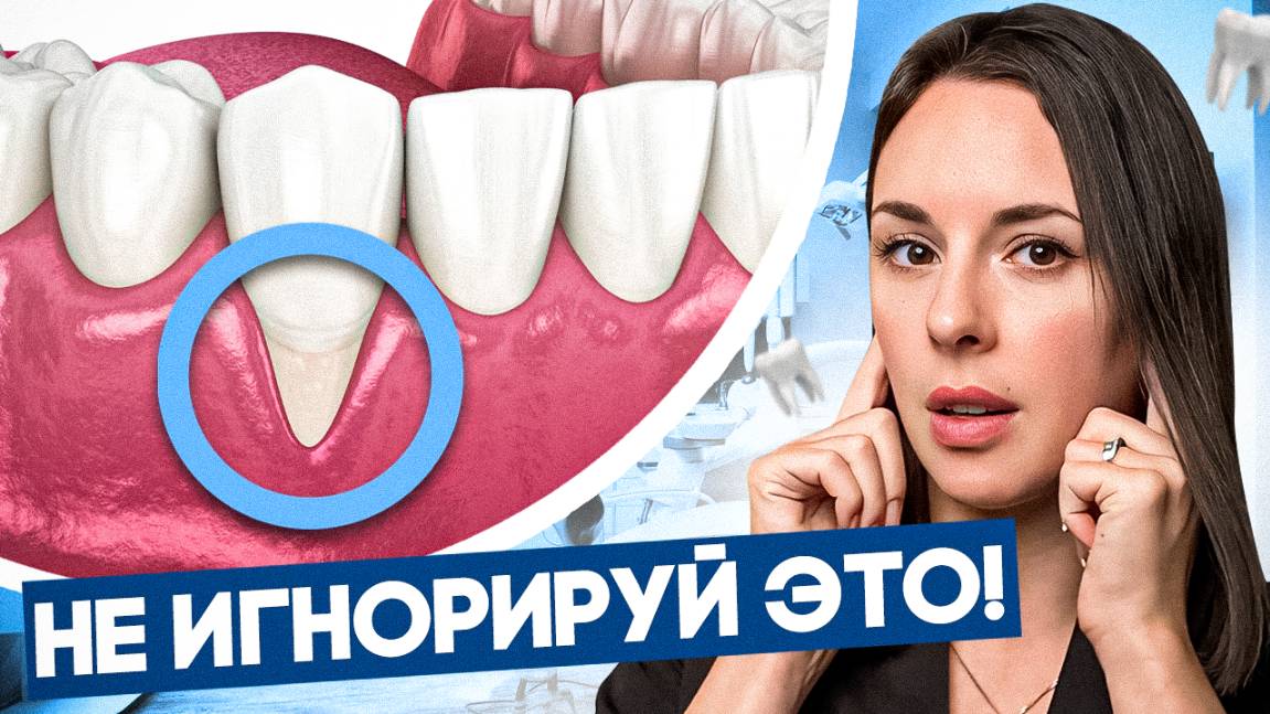 3 ПРИЧИНЫ Рецессии Десны | Уменьшается десна - ЧТО ДЕЛАТЬ?!
