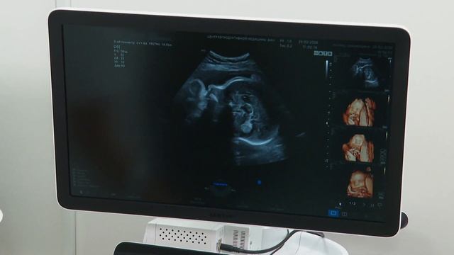 Центр репродуктивной медицины АИст: лечение бесплодия
