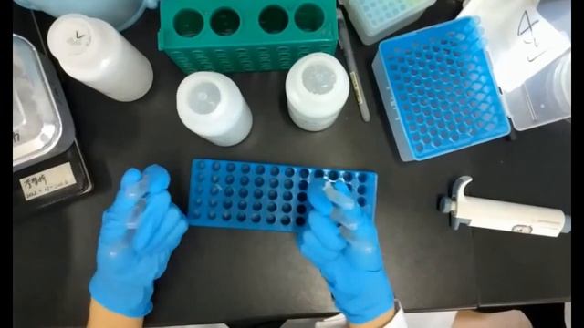 Plasmid Extraction from E.coli Bacteria