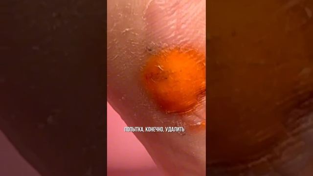 К чему привёл китайский препарат