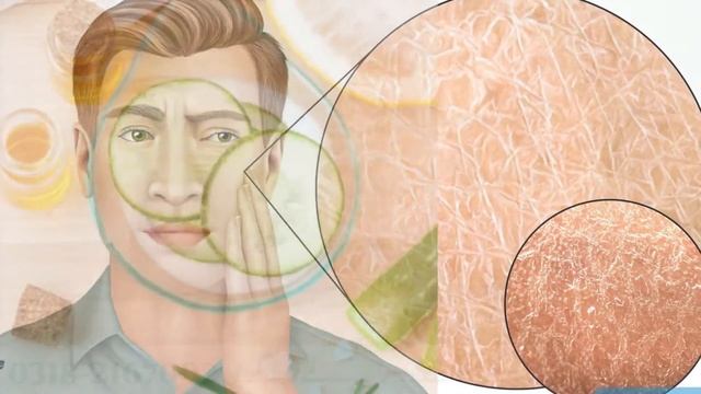 Pigmentation and Scars - Tibb e Nabvi treatment of Glowing Skin